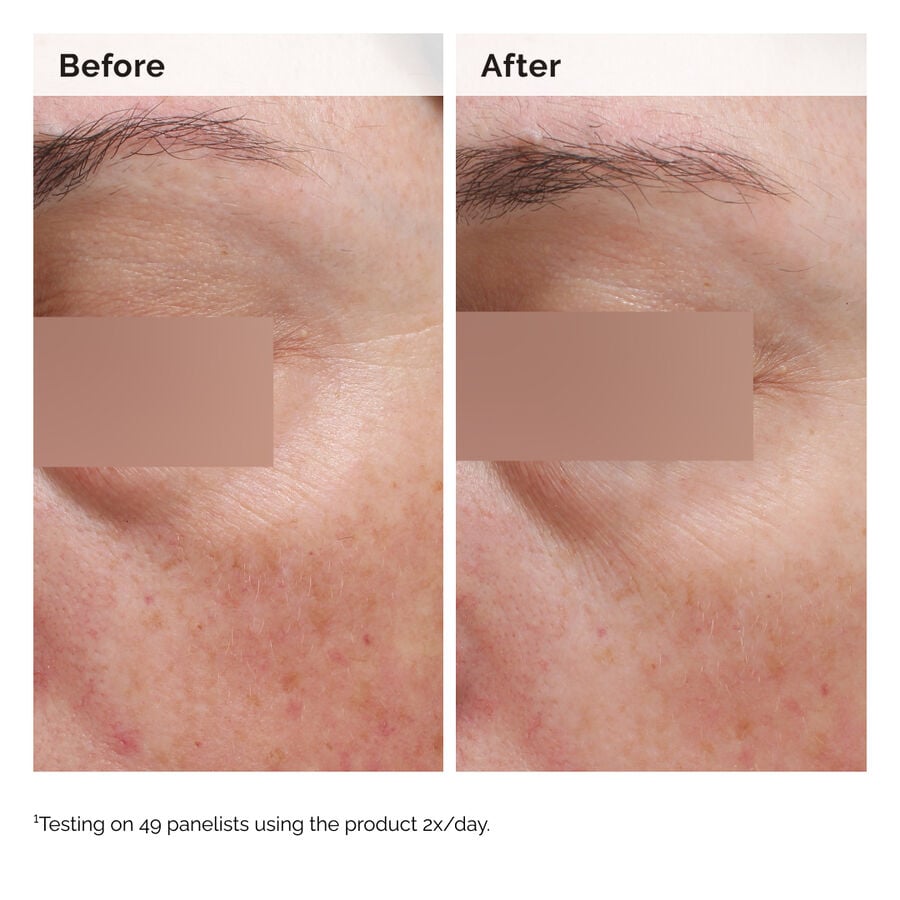 niacinamide-5-face-and-body-emulsion-m8 2024-08-23-ORD-Nia-5pct-Face-Body-B-A-Elasticity-Global-02-1x1.jpg