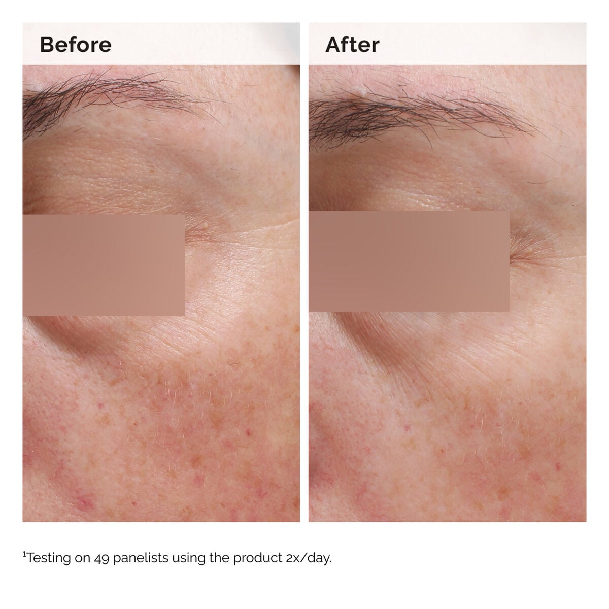 niacinamide-5-face-and-body-emulsion-m8 2024-08-23-ORD-Nia-5pct-Face-Body-B-A-Elasticity-Global-02-1x1.jpg