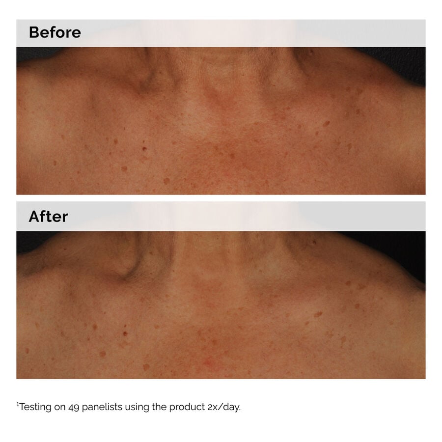 niacinamide-5-face-and-body-emulsion-h4 2024-08-23-ORD-Nia-5pct-Face-Body-B-A-Global-02-1x1.jpg