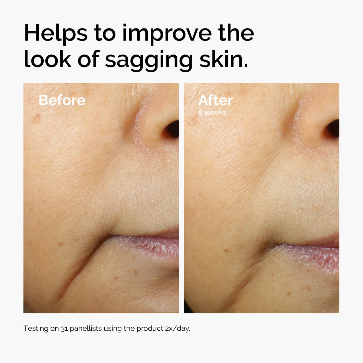 caffeine-3-escin-1-face-serum-h1 ord-caffeine-3pct-escin-1pct-face-serum-before-after-sagging.jpg