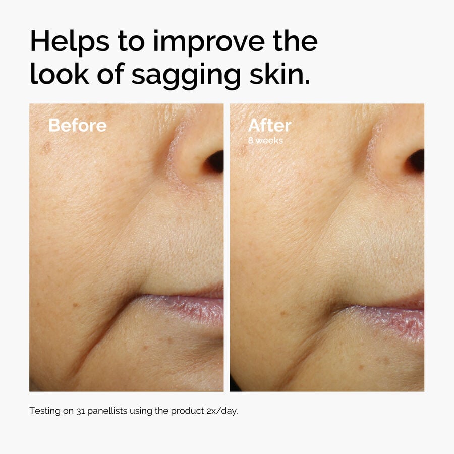 caffeine-3-escin-1-face-serum-h1 ord-caffeine-3pct-escin-1pct-face-serum-before-after-sagging.jpg