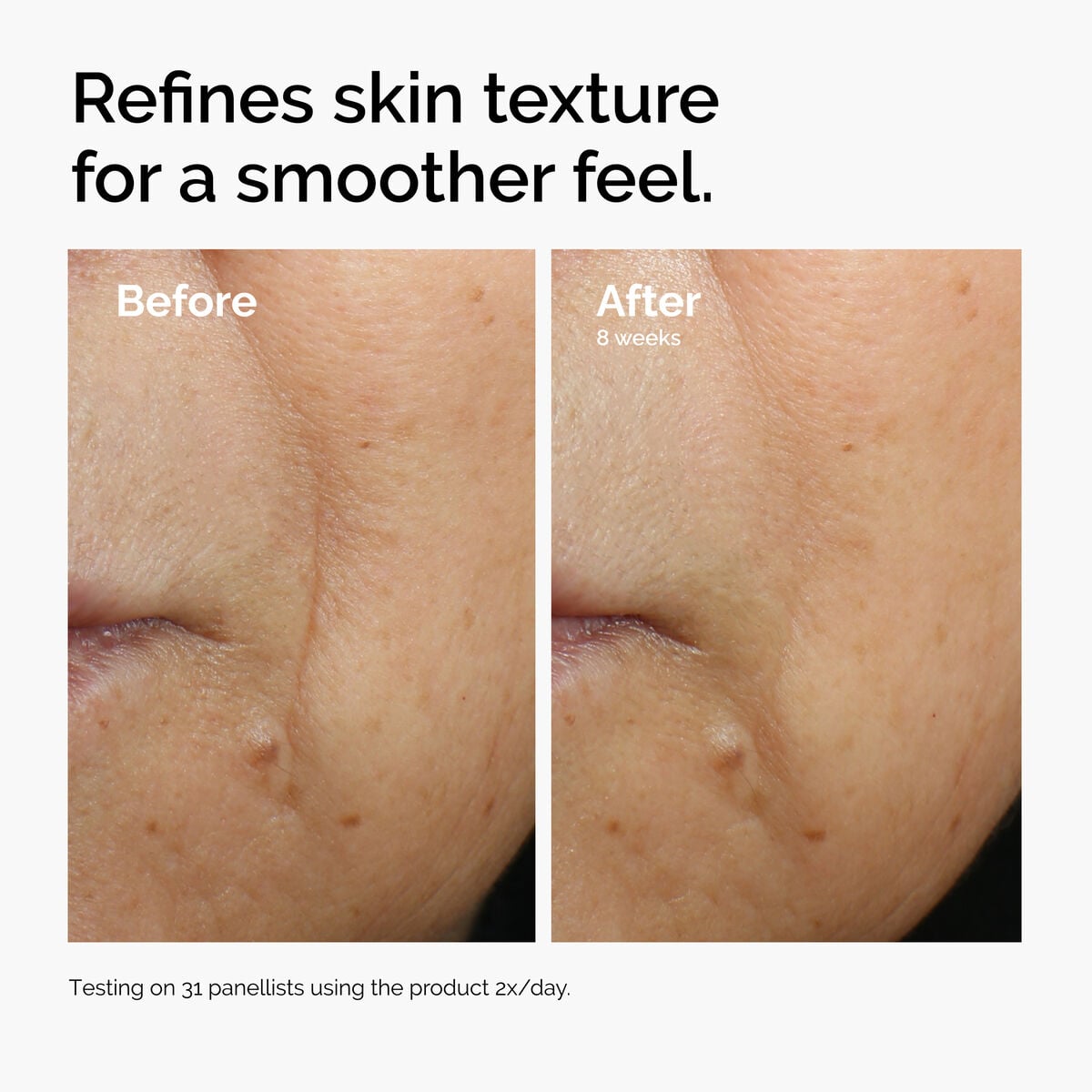 caffeine-3-escin-1-face-serum-h1 ord-caffeine-3pct-escin-1pct-face-serum-before-after-texture.jpg
