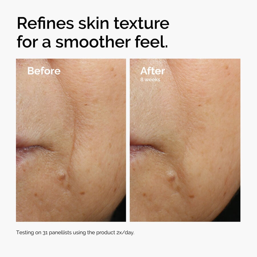caffeine-3-escin-1-face-serum-h1 ord-caffeine-3pct-escin-1pct-face-serum-before-after-texture.jpg