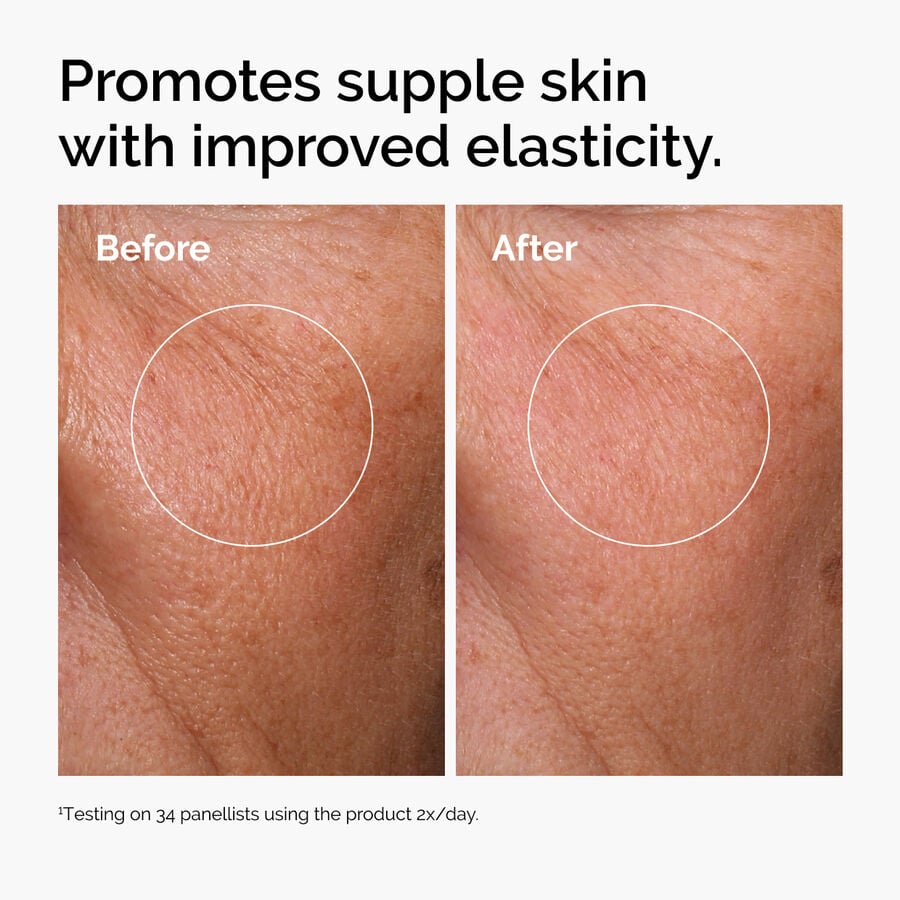 hyaluronic-acid-2-b5-with-ceramides-a4 ord-hyaluronic-acid-2pct-b5-hydrating-serum-before-after-elasticity.jpg