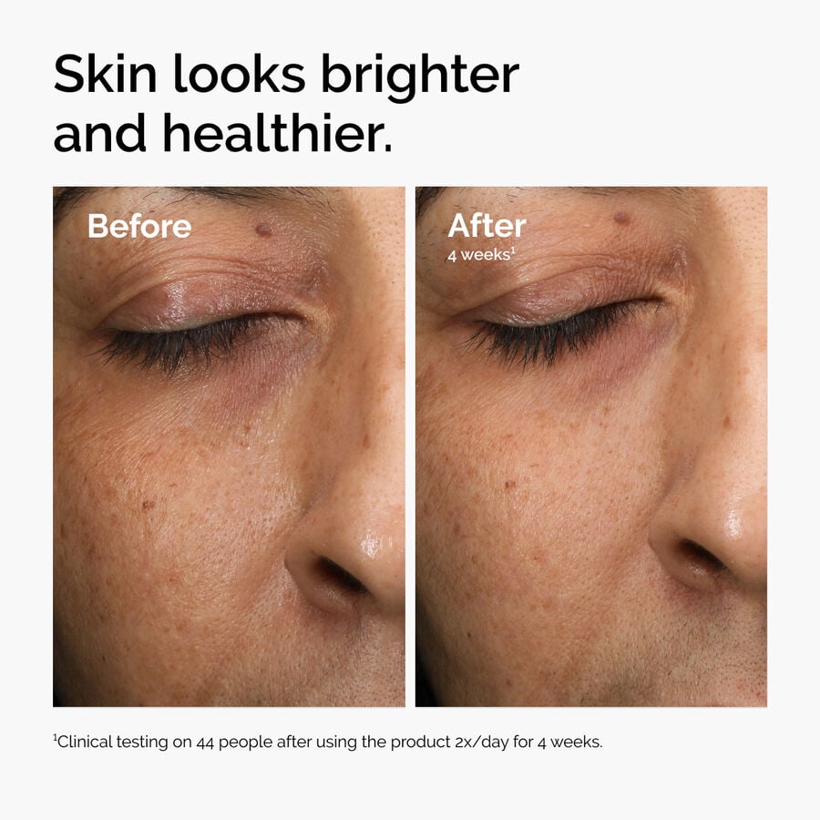 multi-antioxidant-radiance-serum-c5 ord-mars-before-after-healthy.jpg