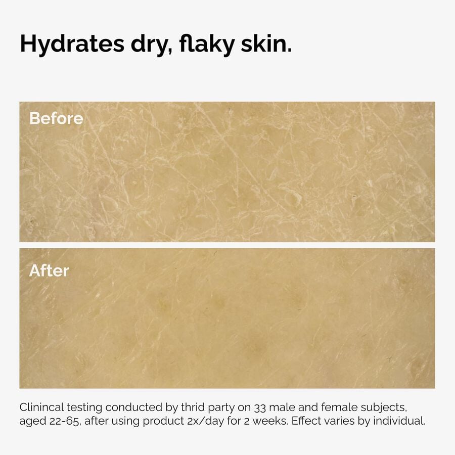 the-body-care-collection-q3 ord-natural-moisturizing-factors-inulin-body-before-after-graphic-02.jpg