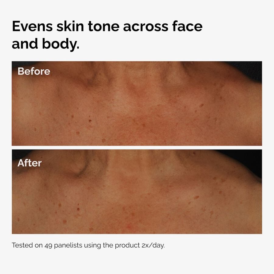 the-body-care-collection-q3 ord-niacinamide-face-body-serum-before-after-even-tone-graphic.jpg