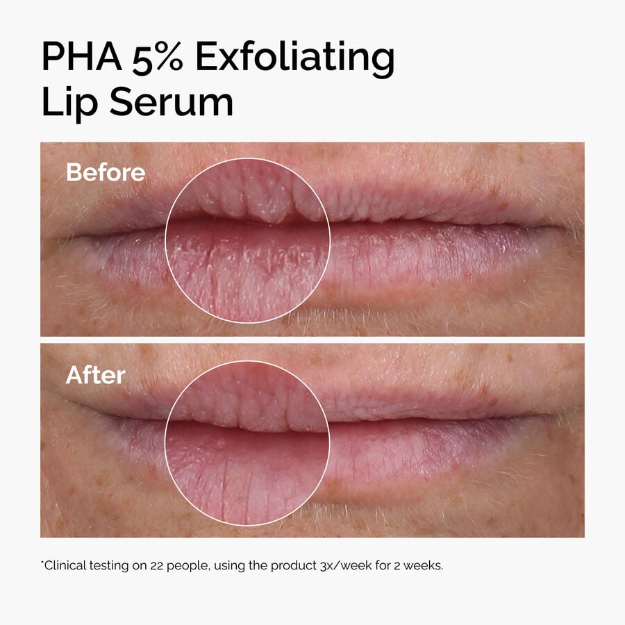 pha-5-exfoliating-lip-serum-f8 ord-pha-5pct-lip-exfoliating-serum-before-after.jpg